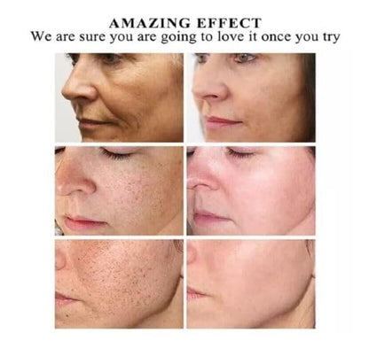 Guanjing Kojic Acid Collagen Whitening Facial SerumGuanjing Kojic Acid Collagen Whitening Facial SerumGuanjing Kojic Acid Collagen Whitening Facial Serum Guanjing Kojic Acid Collagen Whitening Facial Serum
