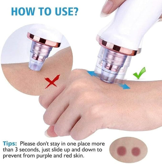 Blackhead Remover Multifunctional 6 in 1 Tool | Electric Derma suction Machine | Pimple Acne Pore Cleaner Vacuum Tool | USB Rechargeable | Facial Cleanser Device for Nose & Skin Care | For MEN & WOMEN