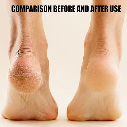 Electric Foot Callus Remover, Rechargeable Foot File Pedicure Machine with 2 Roller Heads, Soft Feet, Waterproof Pedicure Tool for Removing Dead Skin, Hard Skin & Cracked Heels for Men & Women