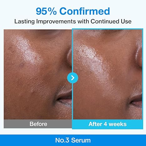 Numbuzin No.3 retinol Serum | Blue Bio-Retinol Pore Refining Serum | Retinol Beginner, Tightening, Firming, BHA, Niacinamide, Peptide | 1.01 fl.0z (30ml)