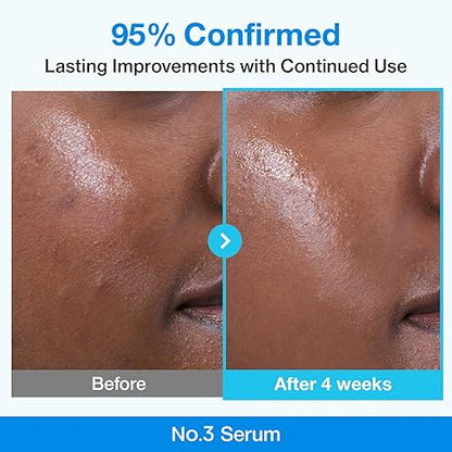 Numbuzin No.3 retinol Serum | Blue Bio-Retinol Pore Refining Serum | Retinol Beginner, Tightening, Firming, BHA, Niacinamide, Peptide | 1.01 fl.0z (30ml)