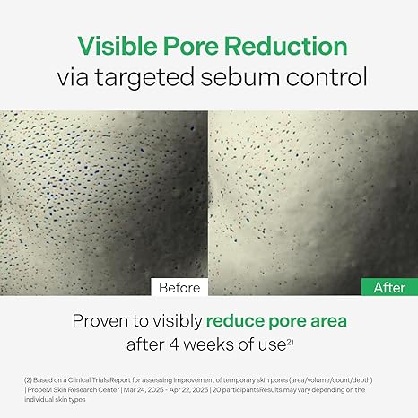 Torriden BALANCEFUL Control Serum 50ml (1.69 fl.oz.) | Daily Sebum & Oil Control for Sensitive Skin | 5D Complex Cica, 4% Niacinamide | Korean Facial Serum