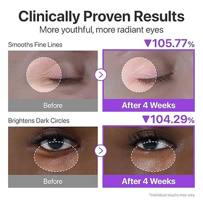 numbuzin No.9 NAD+ Retinol Eye Cream, Depuffing & Firming Eye Serum for Dark Circles, Wrinkles & Fine Lines, Peptides & Niacinamide for Glow & Undereye Radiance, Stocking Stuffers 0.33 fl oz