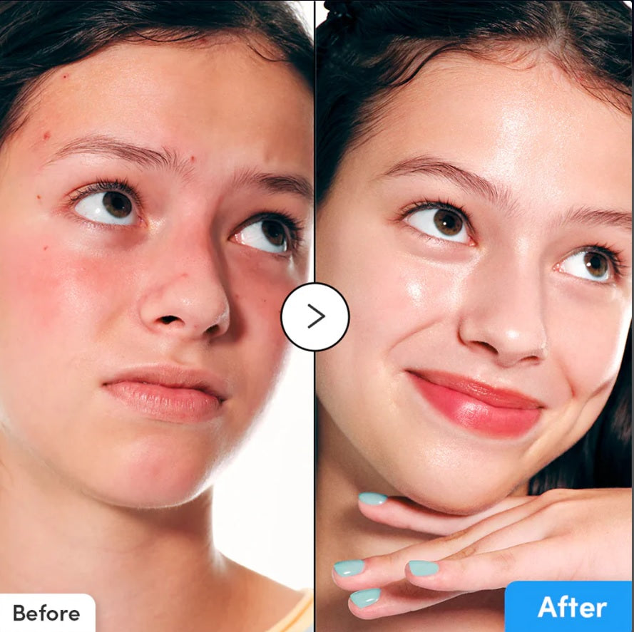 EQQUALBERRY Hyaltoin Flooding Serum