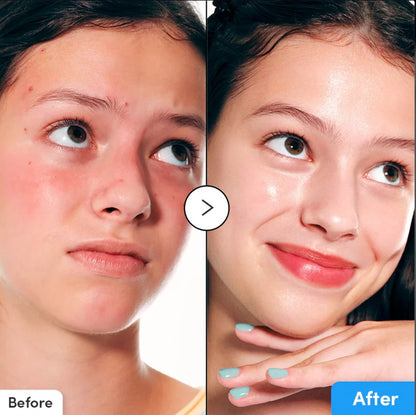 EQQUALBERRY Hyaltoin Flooding Serum