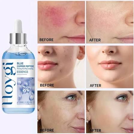 Blue Copper Peptide Anti-Aging Serum- Skin Revitalizing Formula with Brightening Essence for Radiant Face 30ml