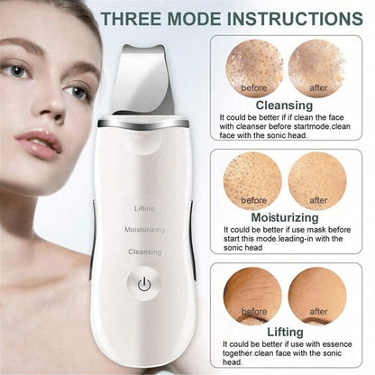 Deep Cleansing Facial Skin Scrubber | Face Spatula Exfoliator & Blackhead Pore Cleaner