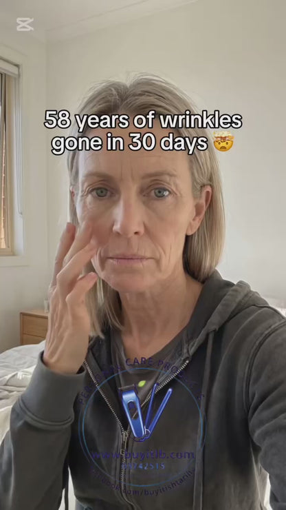 Intense Pulsed Light Wrinkles Reducing Instrument