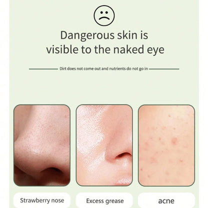 Deep Cleansing Facial Skin Scrubber | Face Spatula Exfoliator & Blackhead Pore Cleaner
